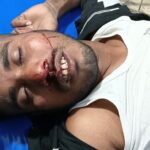প্রতিষ্ঠার ১১ বছরে হয়নি পটুয়াখালী মেডিকেল কলেজ হাসপাতালের যাত্রা