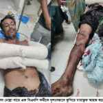 গাজা ও ফিলিস্তিনের সমর্থনে ইসলামী বিশ্ববিদ্যালয়ে সর্বাত্মক শাটডাউন ও প্রতিবাদ