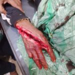 গাইবান্ধায় মাদকাসক্তি নিরাময় ও পুনর্বাসন কেন্দ্রে অমানুবিক নির্যাতনের শিকার