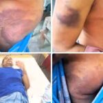 পলাশবাড়ীতে অন্ধকারে দুর্বৃত্তের হামলা যুবদল নেতা গুরুতর আহত