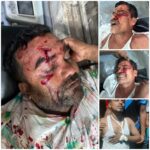 ডেপুটি স্পিকারের উদ্যোগে কলমাকান্দা বাজারে সিসি ক্যামেরা স্থাপন